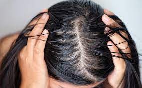 HEALTHY HAIR 1