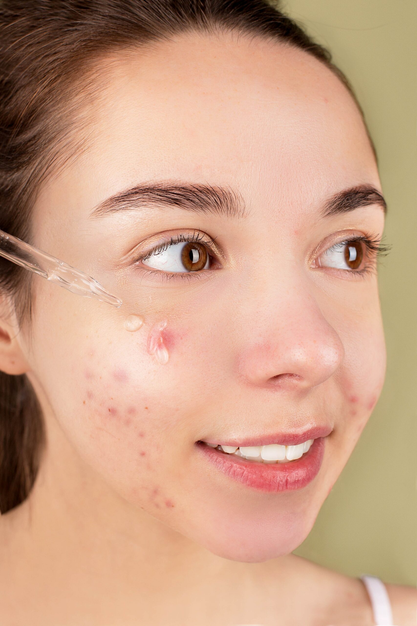 Pimple Patches