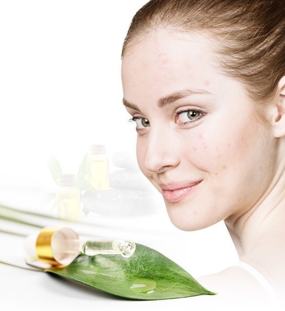 tea tree oil for pimples