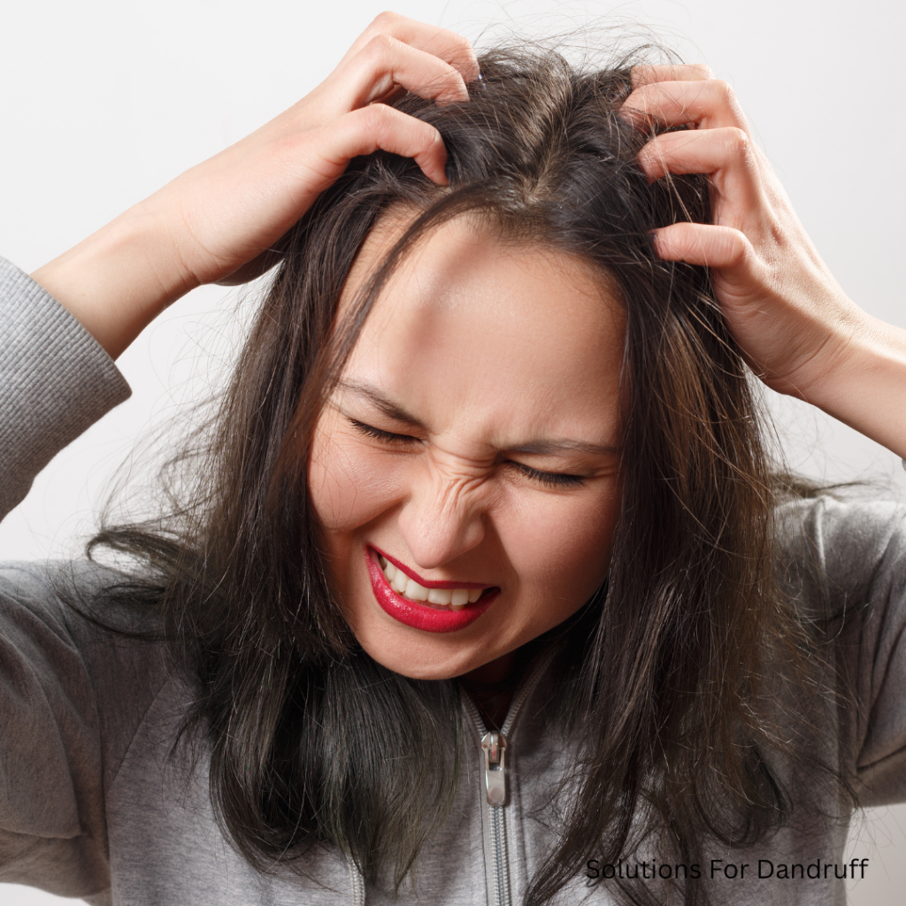 Solutions for dandruff 4