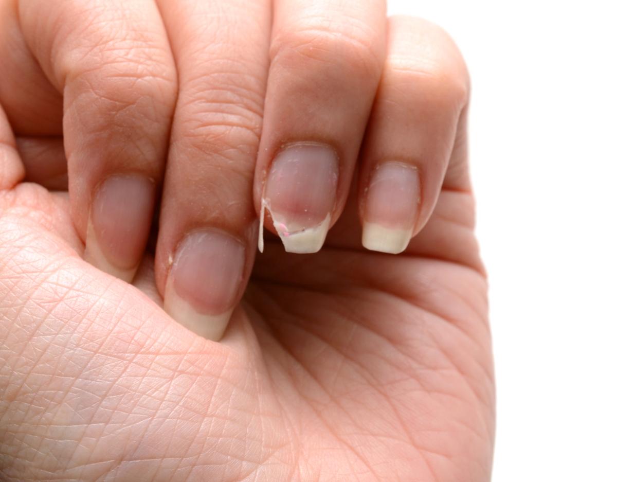 stronger nails with broken nail
