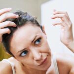 dry scalp vs. dandruff cover