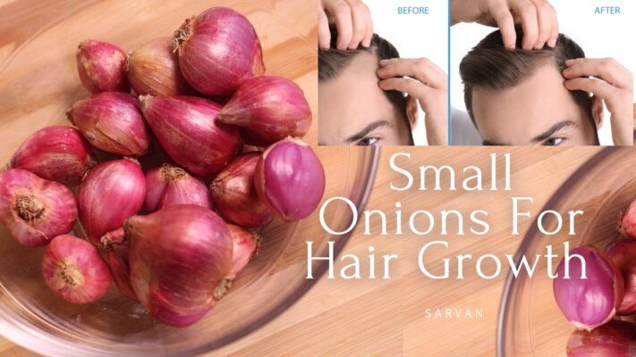 Stunning Onion For Hair Growth Image for Mobile Stunning Onion For Hair Growth Image for Mobile