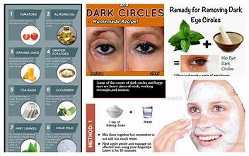 dark circles under the eyes 1