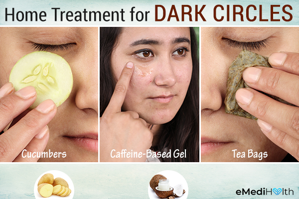 Home treatment dark circles under the eyes