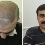 advanced hair treatment solutions