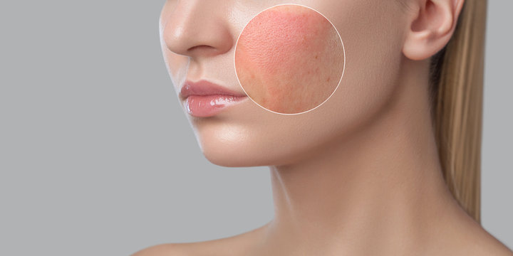 Highlishting skin area on womans face